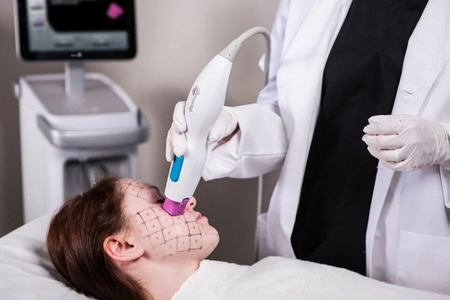 Rejuvenate Your Skin with Thermage FLX A Noninvasive Solution to Youthful Radiance