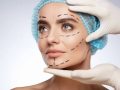 Essential Questions to Ask Before Undergoing Cosmetic Surgery
